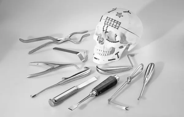 Chirurgische Instrumente für die Mund-Kiefer-Gesichtchirurgie