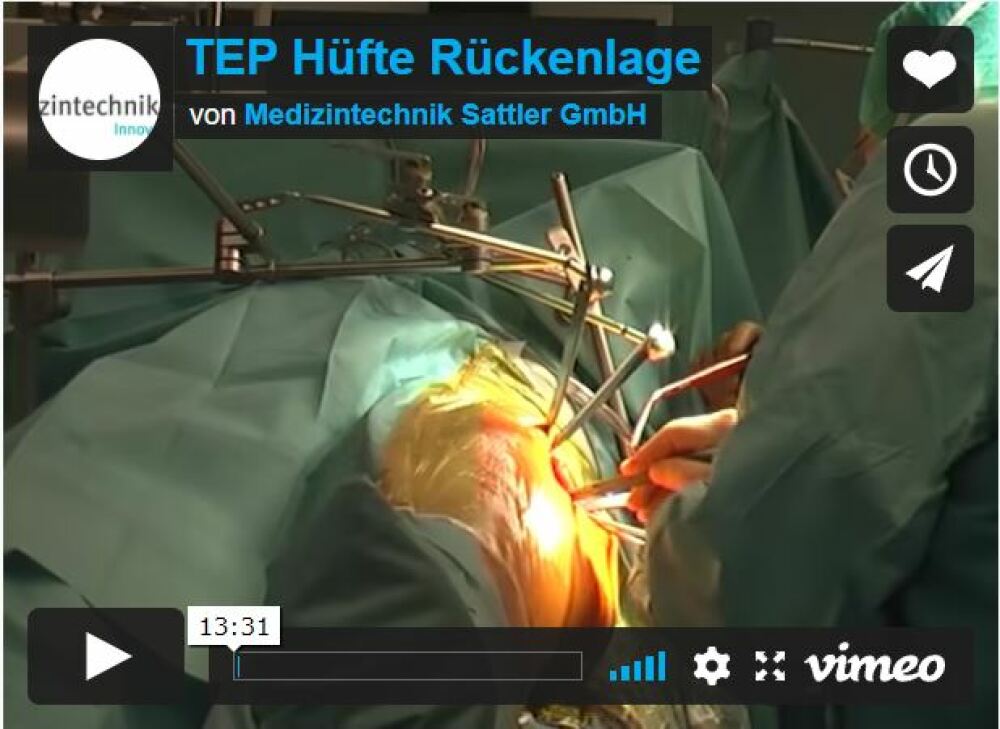 Retractor system TEP in the supine position