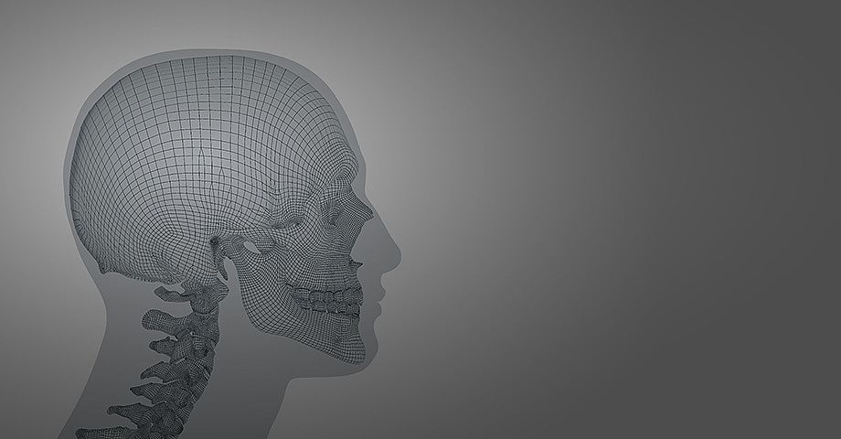 Implants and Implant Systems craniomaxillofacial Surgery