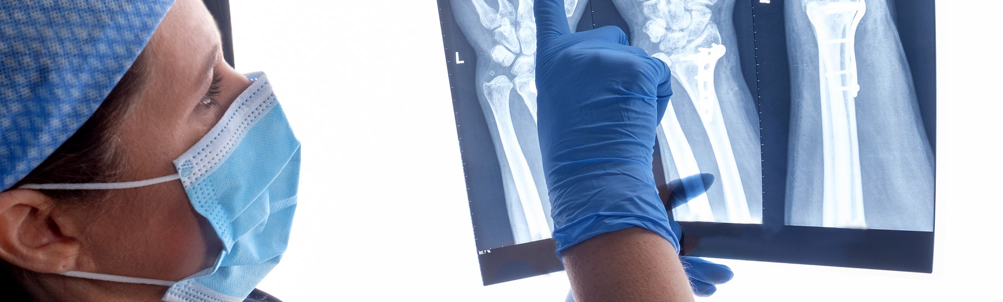Hand Surgery (SUBJECT AREA)